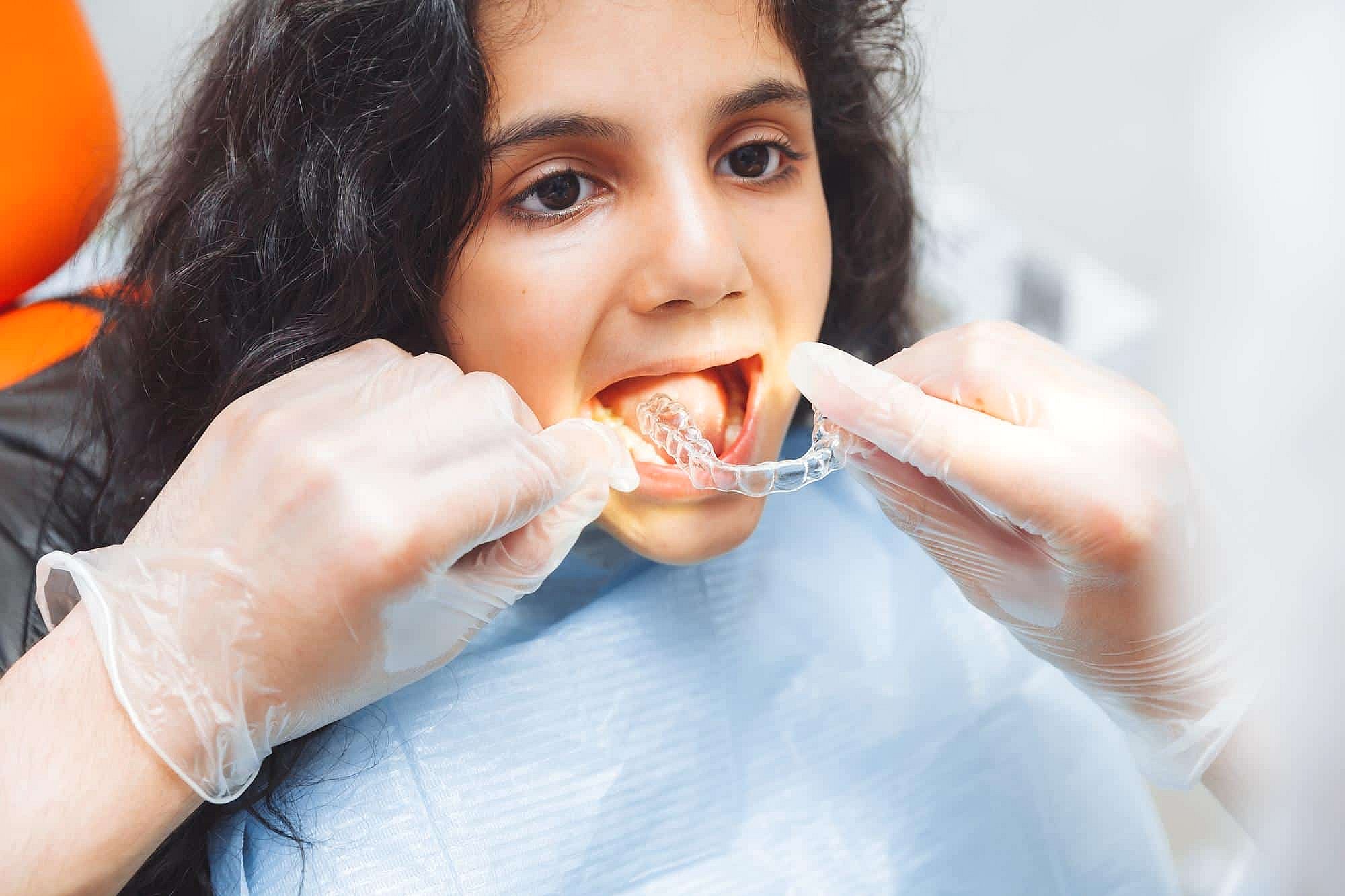 At BeSpoke Orthodontics in Burtonsville, MD, a dentist with gloves fits Clear Aligners on a young patient's upper teeth.