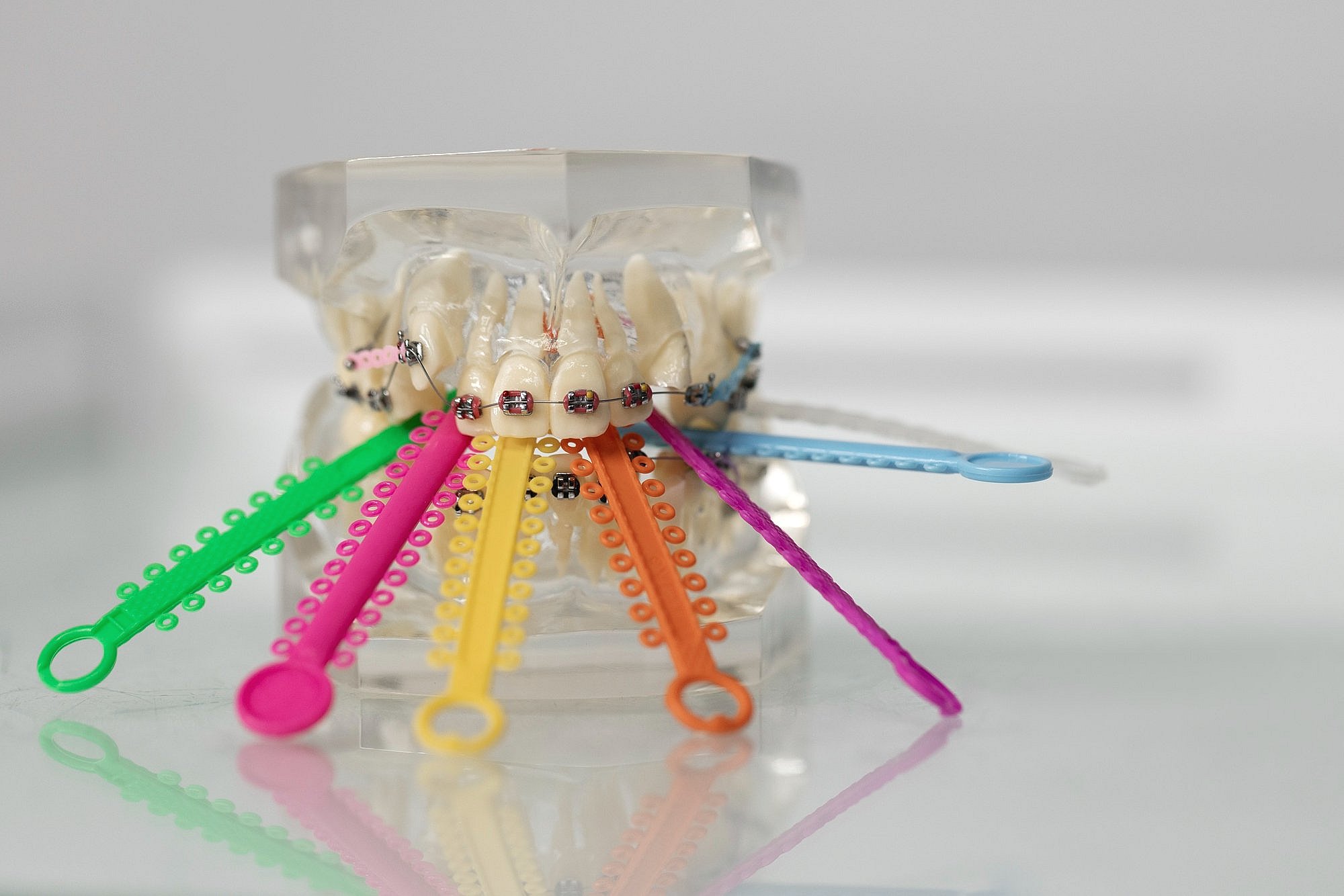 A dental model with metal braces at BeSpoke Orthodontics in Burtonsville, MD displays colorful elastic chains for patient options.