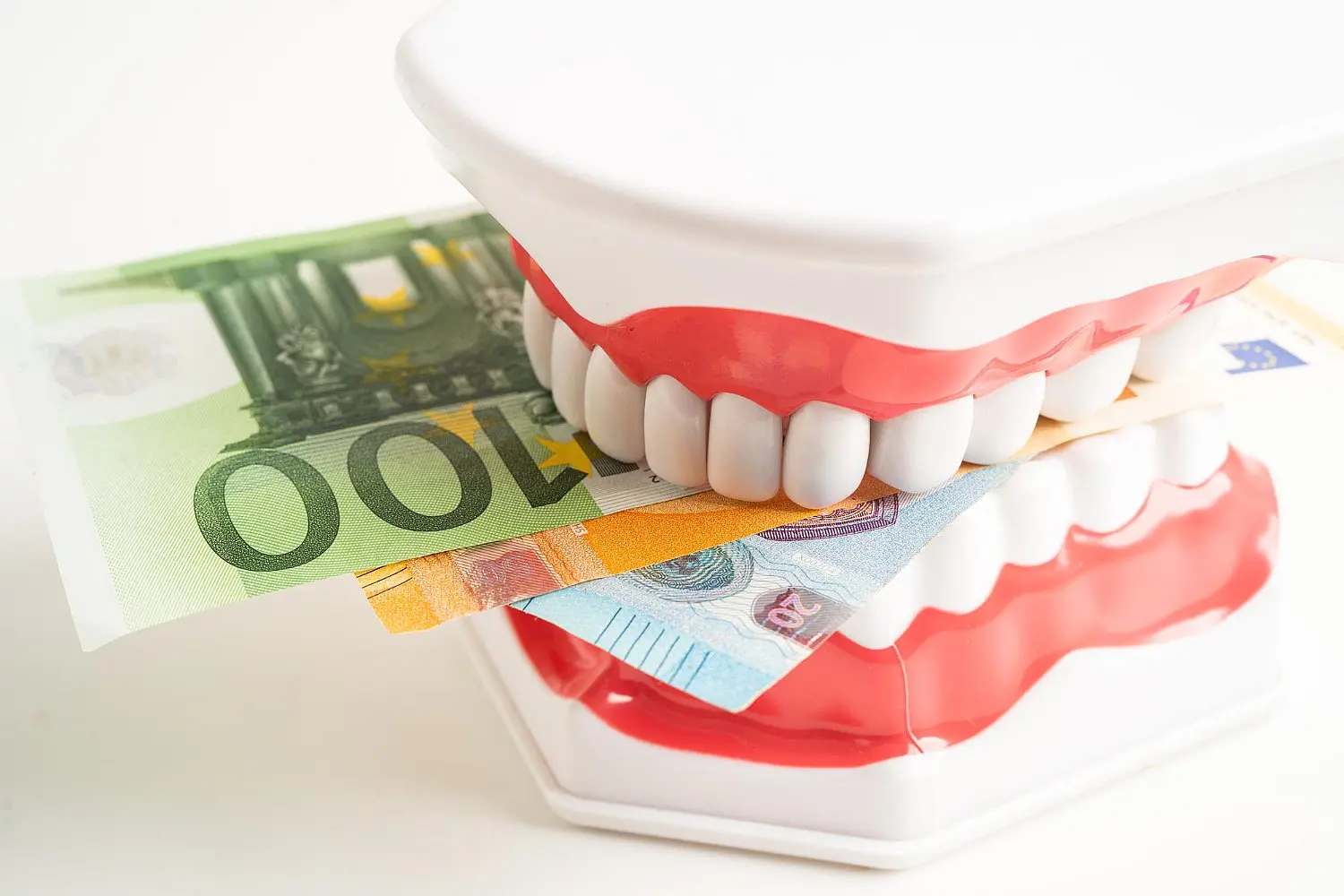 A plastic chattering teeth toy bites a 100 euro note on white, highlighting metal braces cost at BeSpoke Orthodontics in Burtonsville, MD.