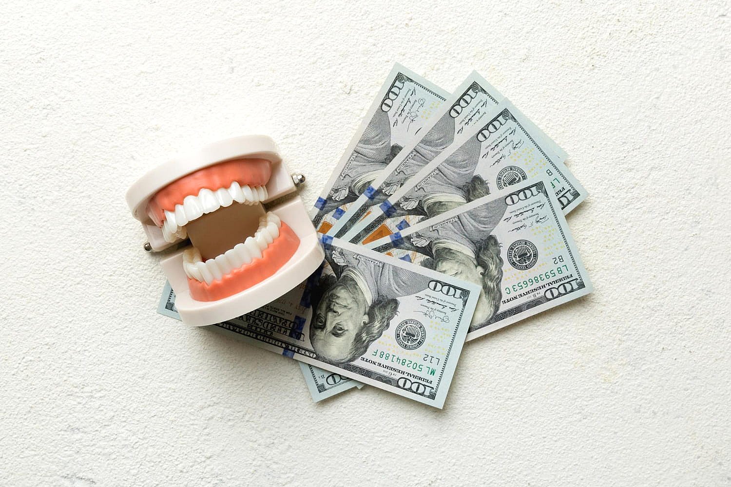 A dental model sits beside five $100 bills on a white surface, representing braces payment plans at BeSpoke Orthodontics in Burtonsville, MD.
