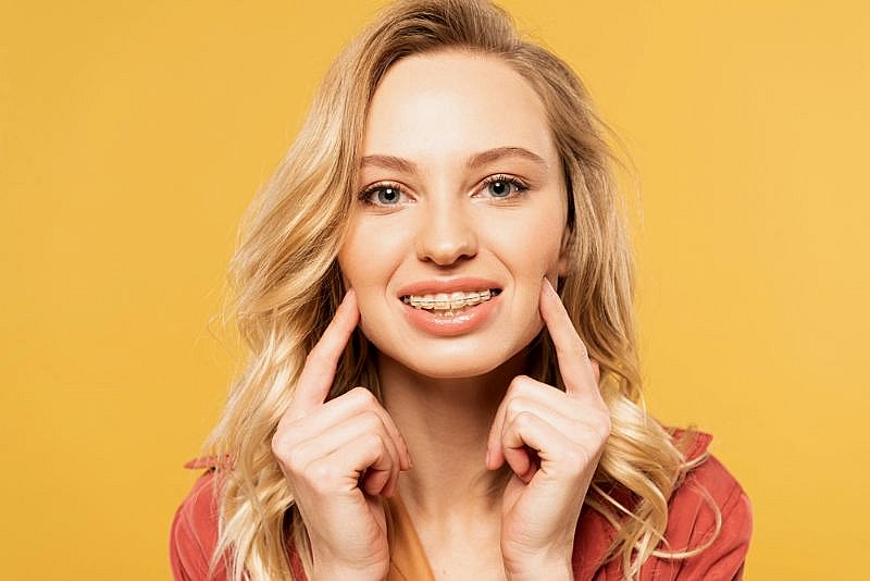 Smiling blonde woman points to her ceramic braces in front of a yellow background at BeSpoke Orthodontics in Burtonsville, MD.
