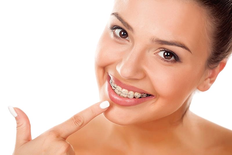 A woman smiles and points at her dental ceramic braces, showing off her BeSpoke Orthodontics treatment in Burtonsville, MD.