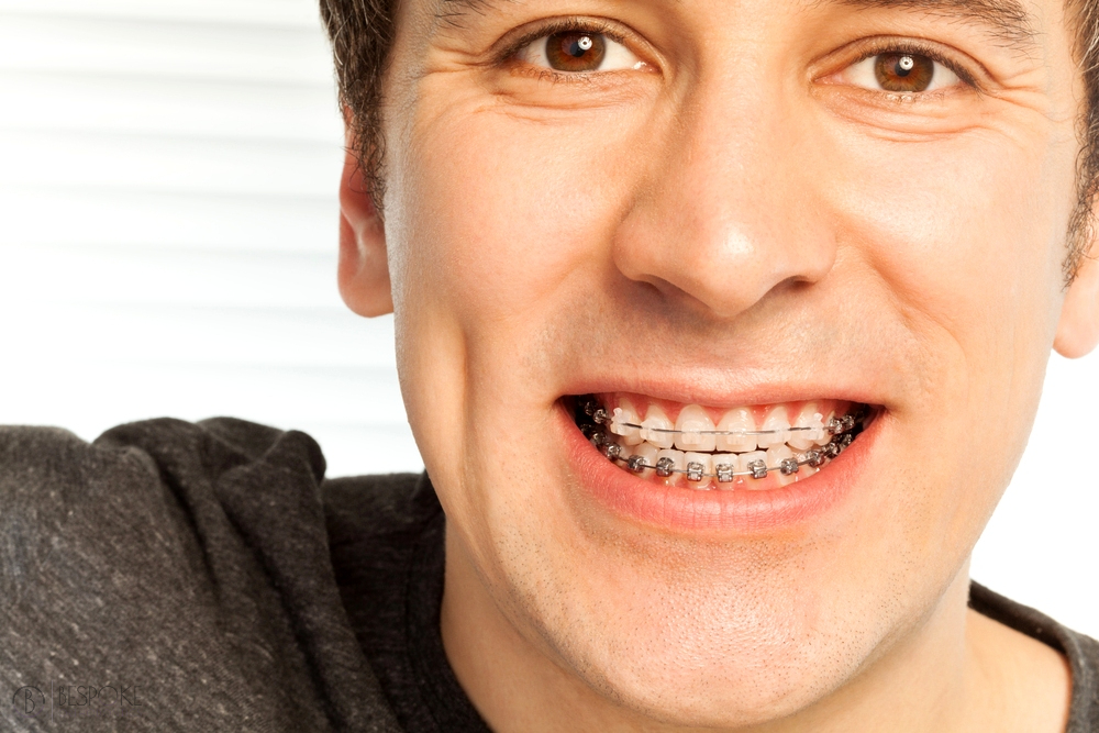 happy young man with metal braces - Overbite vs Underbite in Burtonsville, MD