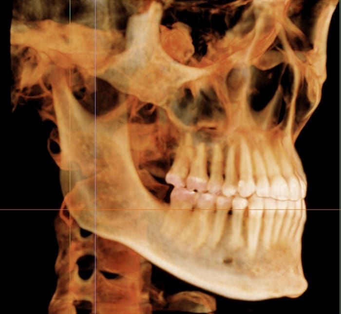 A 3D X-ray image reveals the side view of a human skull and teeth, representing BeSpoke Orthodontics in Burtonsville, MD.